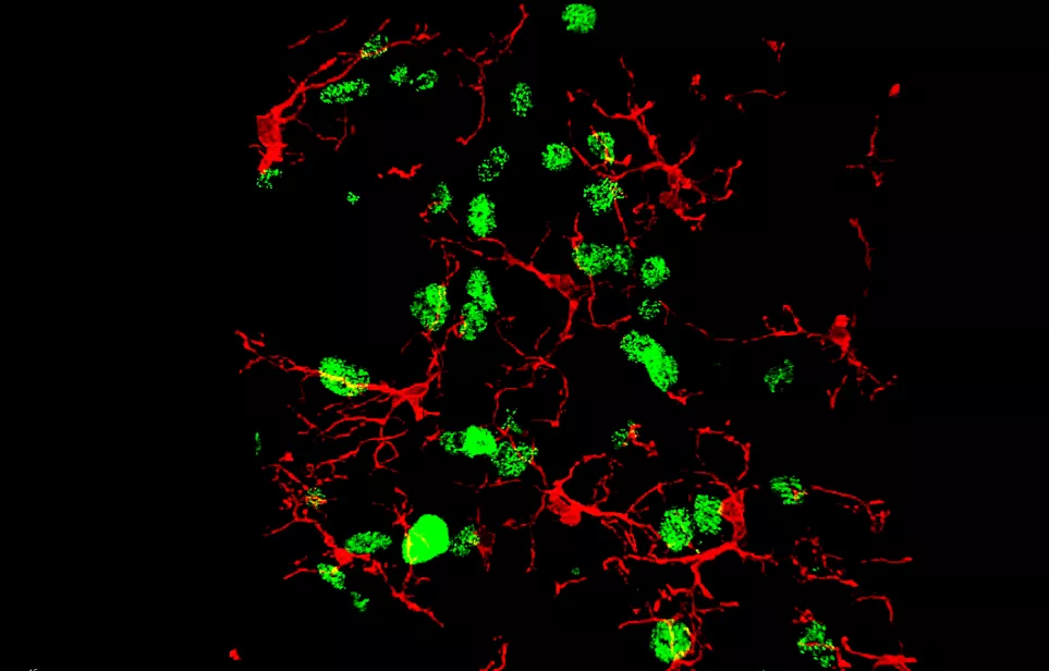Cellules microgliales (cellules inflammatoires – en rouge) à proximité de neurones (cellules vertes) activés lors d’épisodes douloureux.