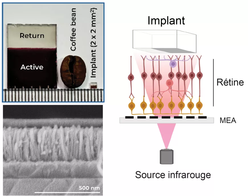 En haut à gauche : à gauche, le dispositif photovoltaïque avant qu’on y découpe l’implant qui est représenté à droite du grain de café ; En bas à gauche : la coupe transverse de l’implant qui est composé d’une couche de matériau nanocristallin interpénétrés de nanofils semi-conducteurs ; A droite : un schéma du dispositif de caractérisation fonctionnelle. La rétine est disposée entre le MEA et l’implant. L’ensemble est éclairé par un rayonnement infrarouge.