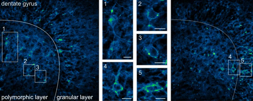 Two-photon image of JARVIS-expressing neurons in the dentate gyrus of the mouse hippocampus. Insets highlight neurons targeted for optical voltage imaging. Scale bar: 10 µm.