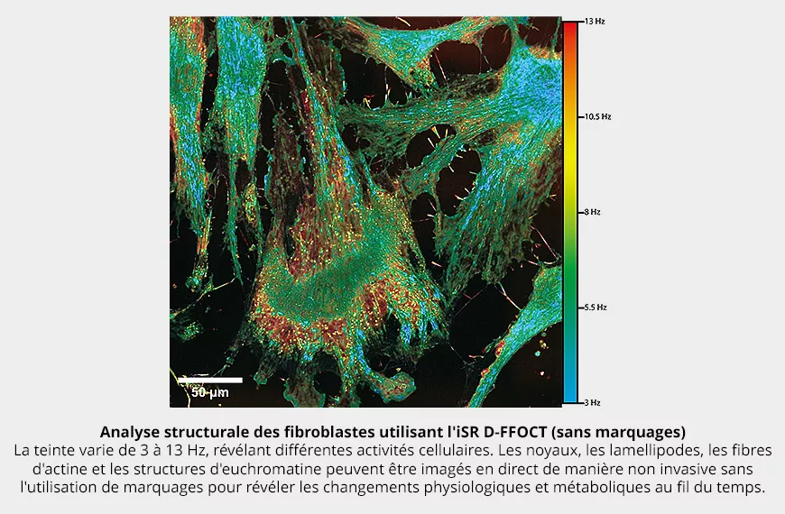 Analyse structurale des fibroblastes utilisant l'iSR D-FFOCT (sans marquages)