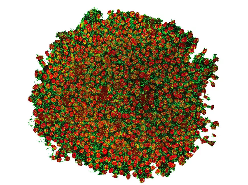 Induced pluripotent stem cell (IPS).