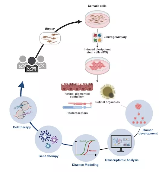 Diagram of the reprogramming of a skin cell into induced pluripotent stem cells